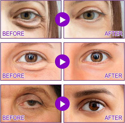 MicroGlow Patches by NOVA LIFT